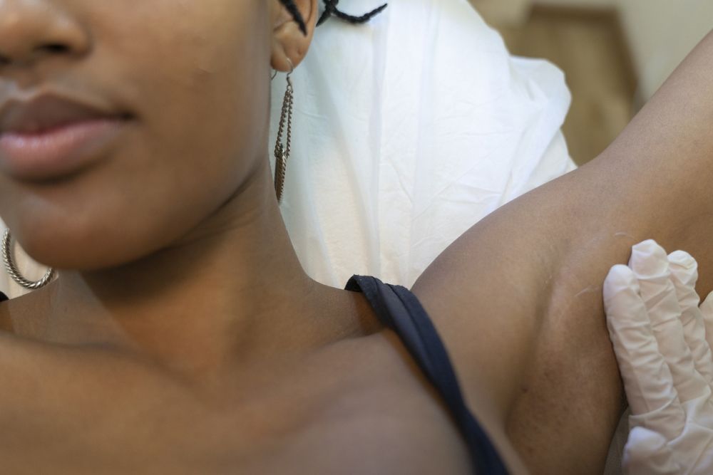 Sugaring: En naturlig metode for skånsom hårfjerning